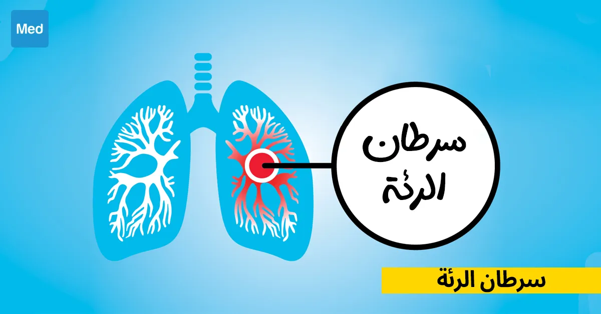 سرطان الرئة